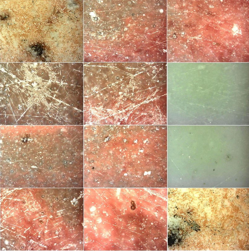 Flower Red Underglazed Meiping